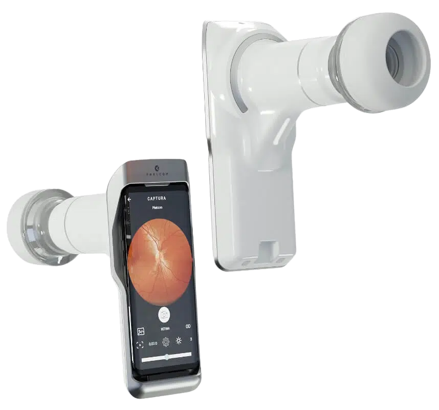 Retinógrafo portátil acoplado a smartphone